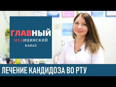 Как лечить грибок во рту в домашних условиях