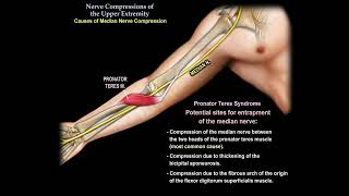nerve pain in  my  arm and hand ? why does it hurt ? Resimi