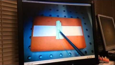 Extracorporeal suturing