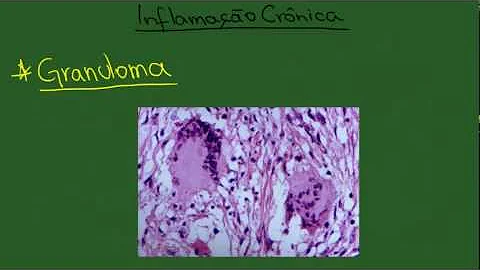 Como se forma granuloma?