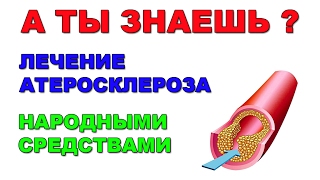 видео Лечение атеросклероза аорты сердца народными средствами