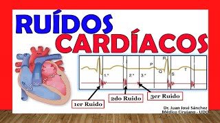 RUIDOS CARDIACOS R1 R2 R3 y R4 Facil Explicacion