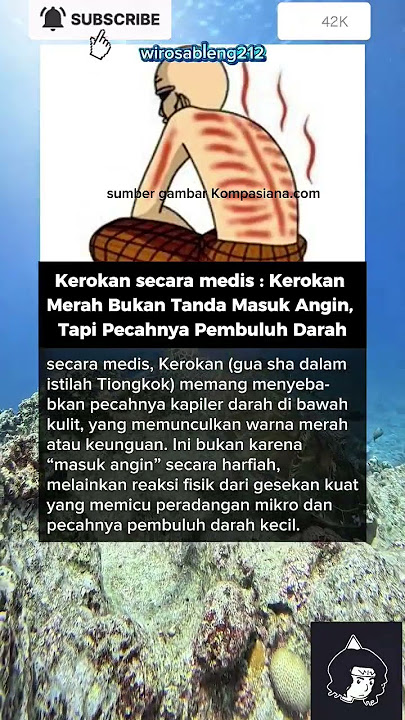 Kerokan Merah Bukan Masuk Angin? Ini Penjelasan Medisnya!