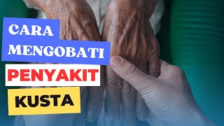 Cara Mengobati Penyakit Kusta lepra
