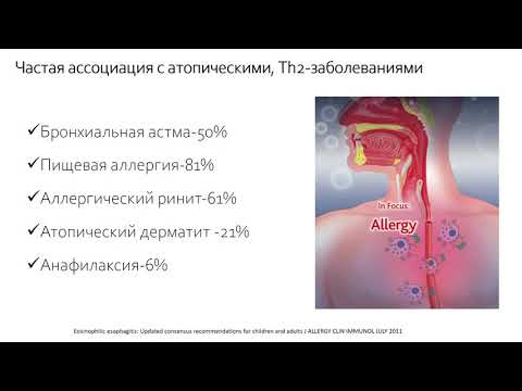 Круглый стол «Эозинофильный эзофагит у детей и взрослых»