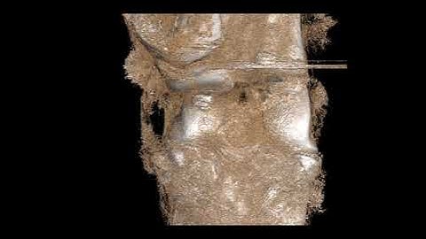 inCiTe micro-CT: Mouse Stifle Joint 3D Video