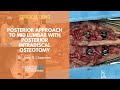 Posterior Approach to Mid Lumbar with Posterior Intradiscal Osteotomy - Jens R. Chapman, MD
