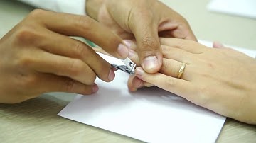 Hướng dẫn thu mẫu móng tay làm xét nghiệm ADN