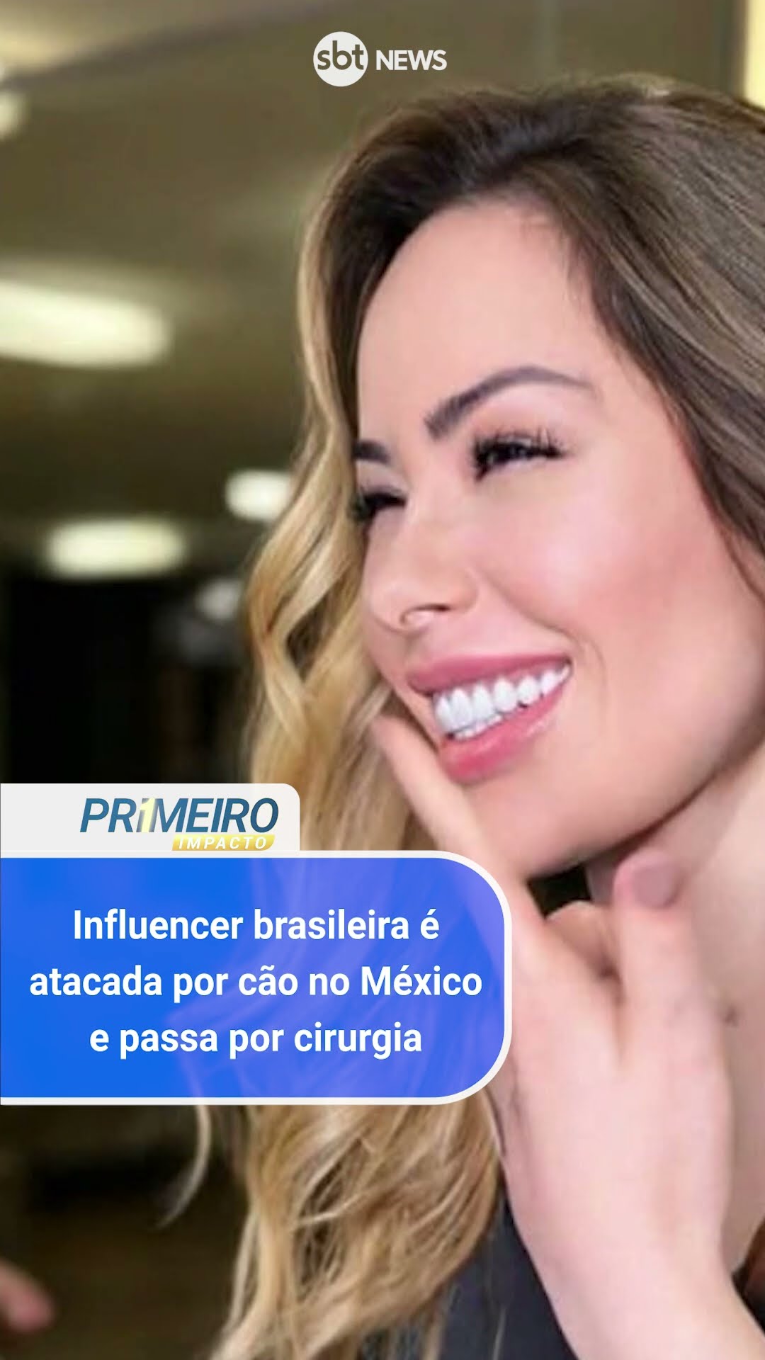 Influencer brasileira é atacada por cão no México e passa por cirurgia