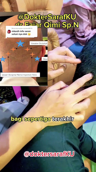 Cara pijat Kepala  Buat Vertigo dan Migrain