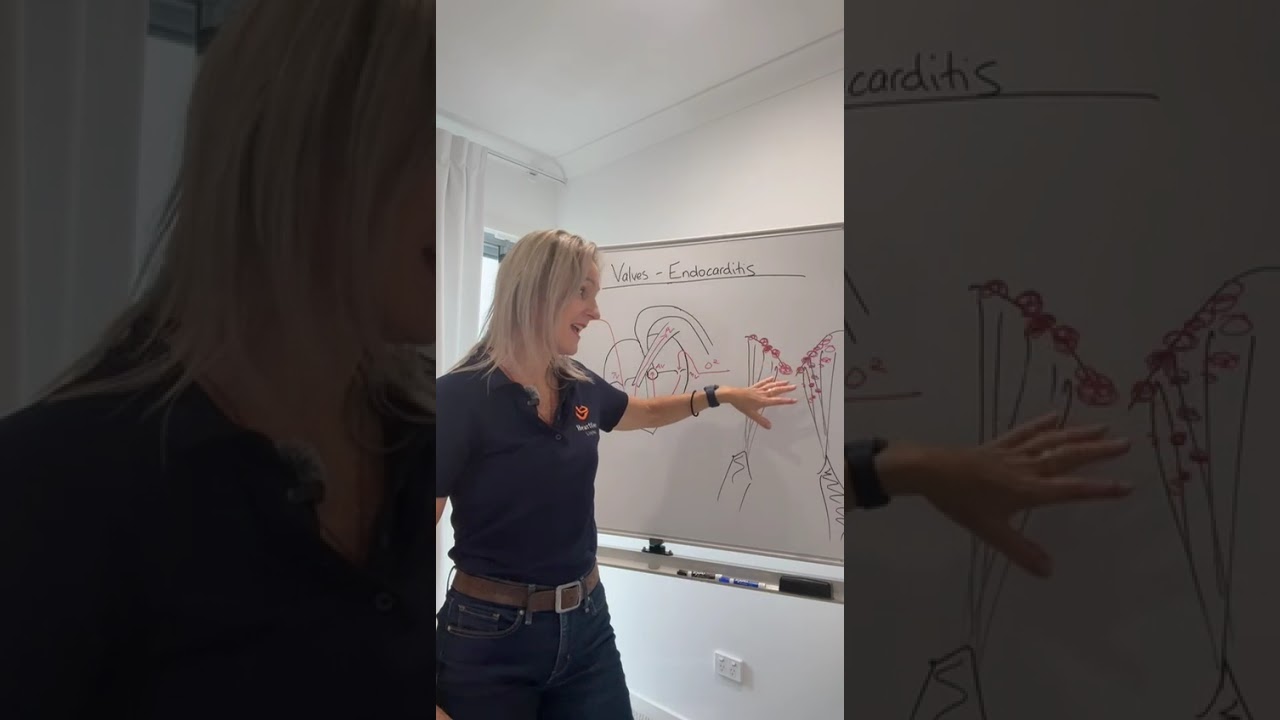 Part 1 of 1 Infective Endocarditis