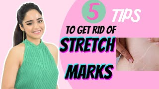 How To Get Rid Of Stretch Marks 3 Diy Homemade Recipes Reviews