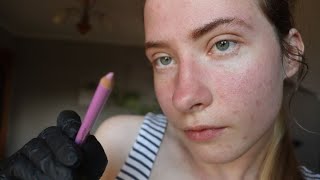 Dermatologist Check up & Treatment | #ASMR