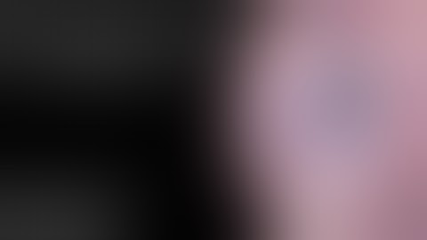 Management of Dislocated IOL