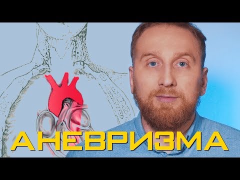 Видео: Клетки синовиальной оболочки при ревматоидном артрите. Дендритные клетки