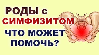 Роды с симфизитом. Избежать Кесарева. Можно ли вылечить симфизит? Упражнения при симфизите.