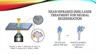 Computational Model for Electromagnetic Gradient Cues Promoting Induced Growth Cone Turning