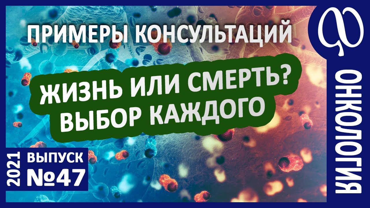 ОНКОЛОГИЯ. Примеры. Наблюдения. Химиотерапия. Лучевая терапия ...