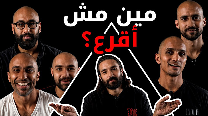 مين مش أقرع؟ | بيننا غريب