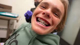 Jazzy Plays a Joke While Jack Gets Braces