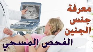 نوع جنس الجنين | الموجات فوق الصوتية التفصيلية (الفحص المسحي أو التشريحي)