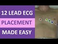 12 Lead ECG Placement Quiz