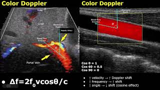 Doppler Ultrasound Physics: Doppler Shift & Equation | Effect of Doppler Angle On Blood Flow Results