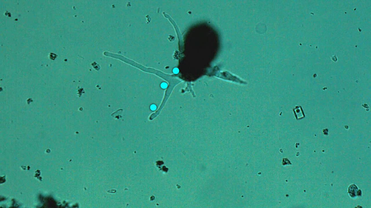 testate amoeba pseudopod forms youtube how do pseudopods form