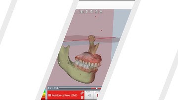 S1E4 - Additional models in the  MODJAW software