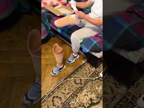 Как самому сделать протез ноги