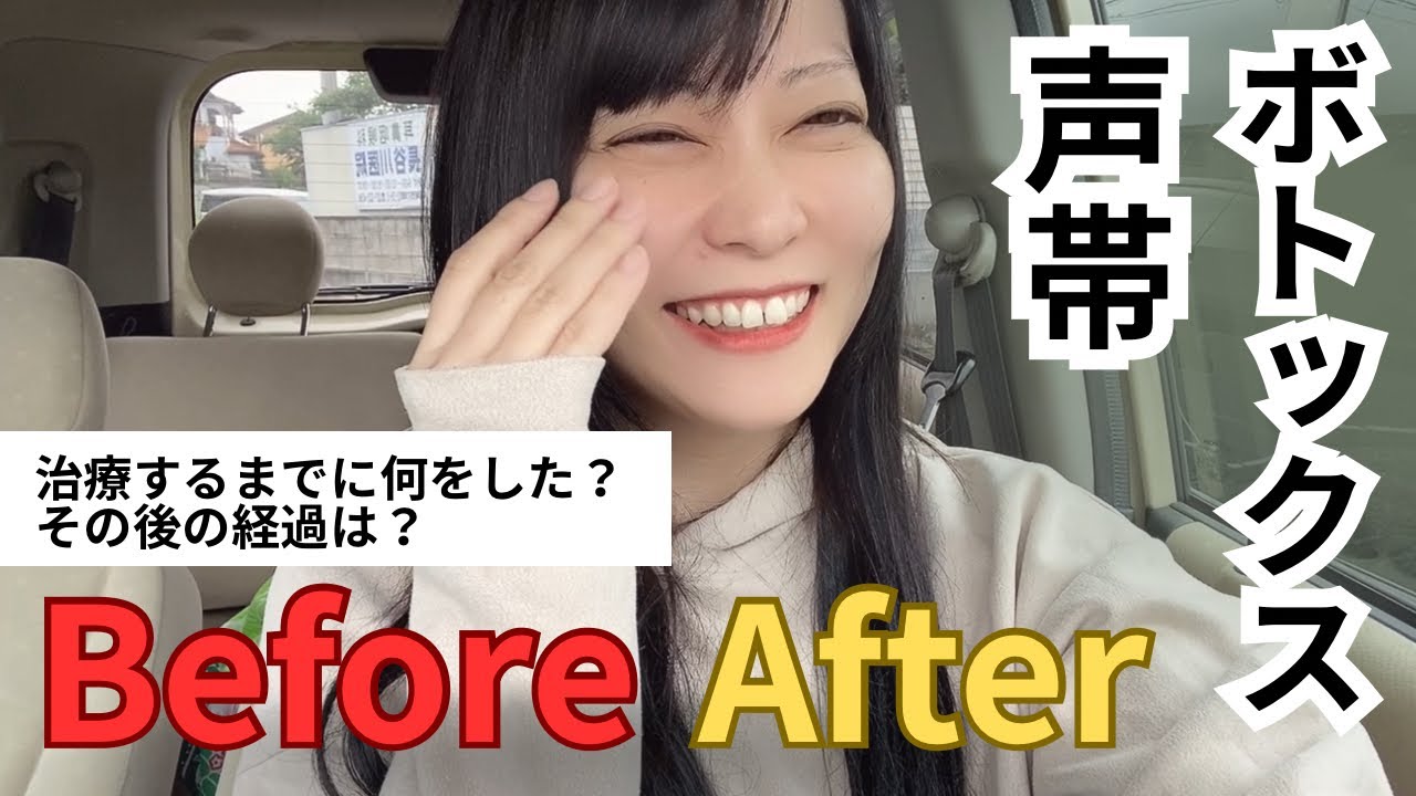 発声障害　ボトックス治療経過観察📝0日〜6週