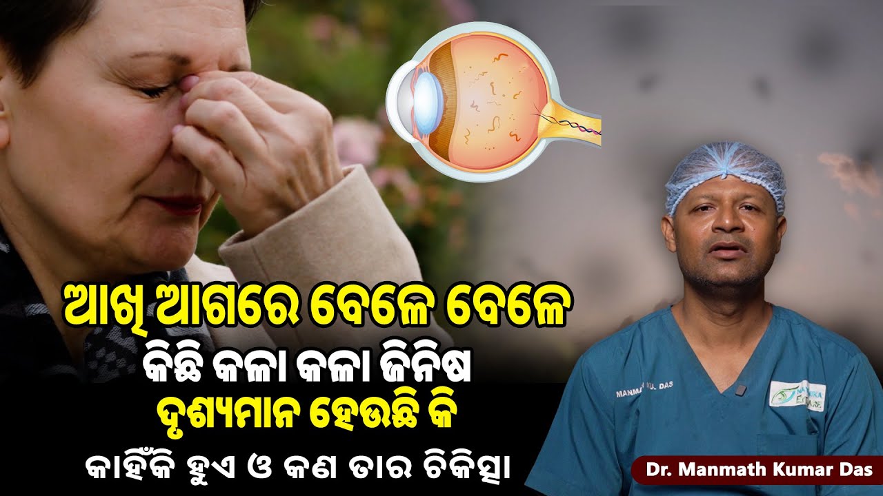 Black Moving Dots in Vision? Eye Floaters Explained & Their Treatment ...