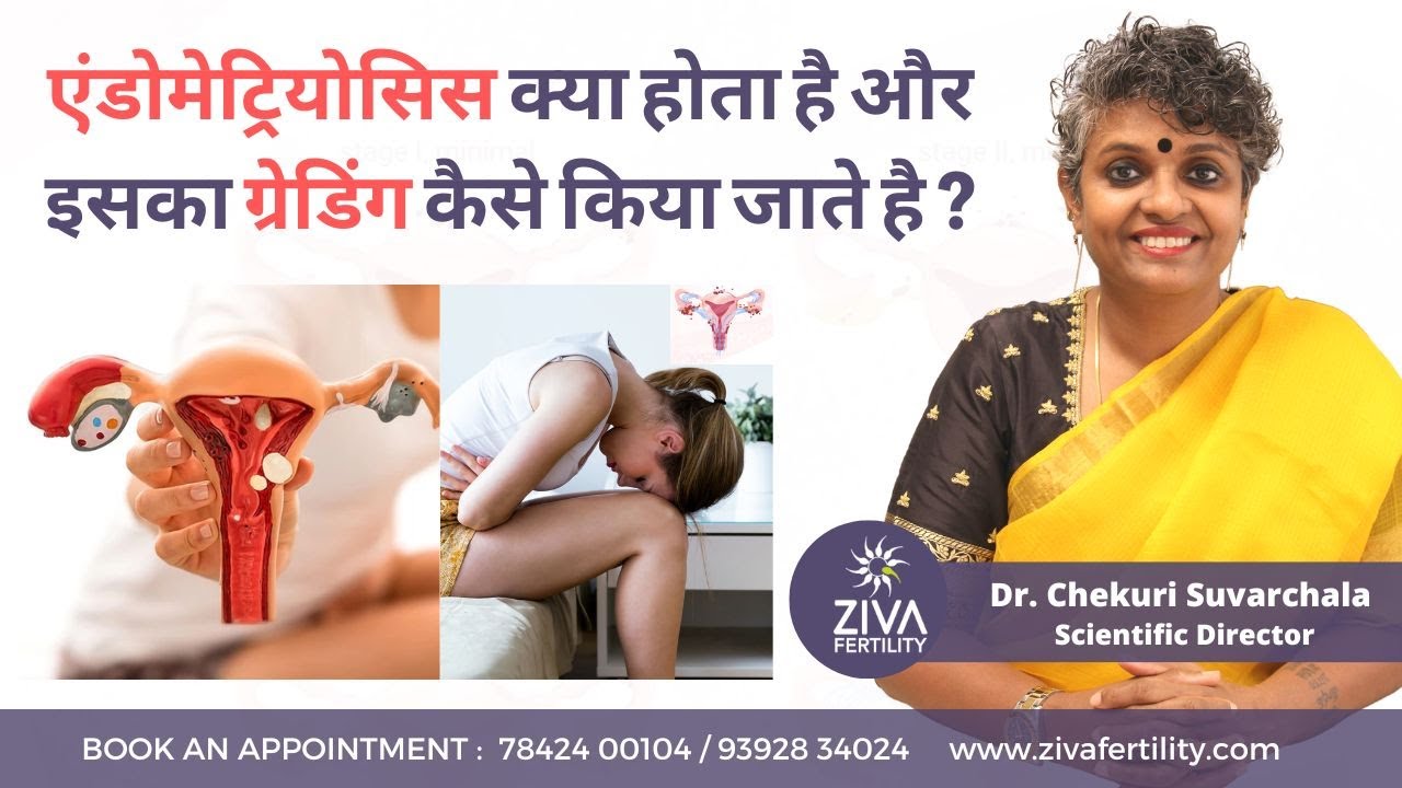Stages Of Endometriosis || एंडोमेट्रियोसिस क्या होता है ? || Dr Chekuri ...