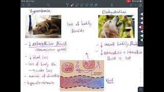 The difference between Dehydration and Hypovolemia