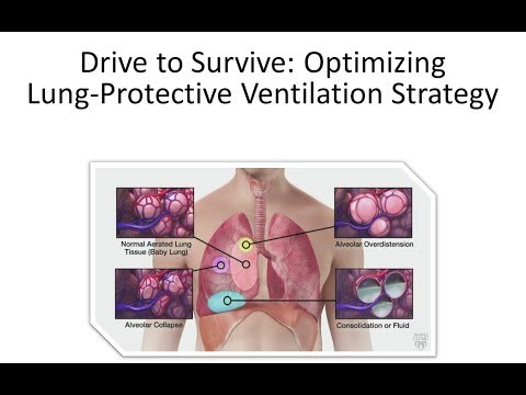 Drive to Survive: