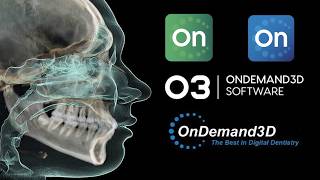 OnDemand3D | برنامج الأسنان الثلاثي الأبعاد شرح عملي screenshot 2