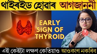 থাইৰইড হোৱাৰ এই কেইটা লক্ষণ আপোনাৰ গাত দেখা দিছে নেকি || Thyroid Symptoms || Ponkhi Sharma by Healthy Life By Ponnkhi Sharrma 133,054 views 1 month ago 8 minutes, 18 seconds