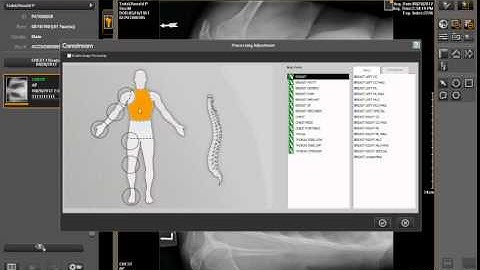 Image Suite procAdjustment