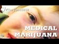 Medical Marijuana For Childhood Epilepsy