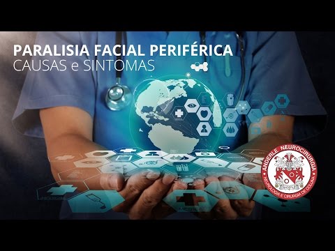 CAUSAS e SINTOMAS DA PARALISIA FACIAL PERIFÉRICA  - Dr Diogo Neurocirurgião