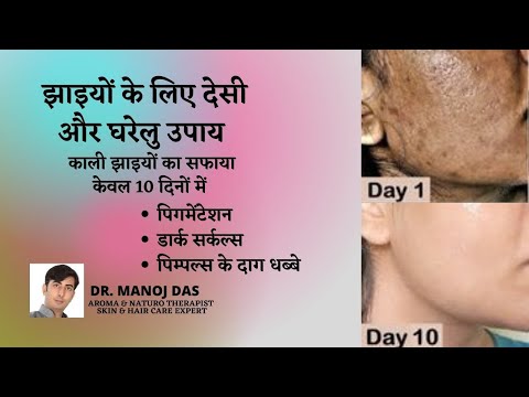 Pigmentation Ka Ilaaj | HOW TO CURE PIGMENTATION I HOW TO LIGHTEN SKIN COLOUR I DR. MANOJ DAS