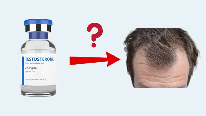 Does High Testosterone/TRT cause Hair Loss?