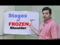FROZEN SHOULDER (adhesive capsulitis)- Stages and causes | NO MORE PAIN #PART1 IN HINDI