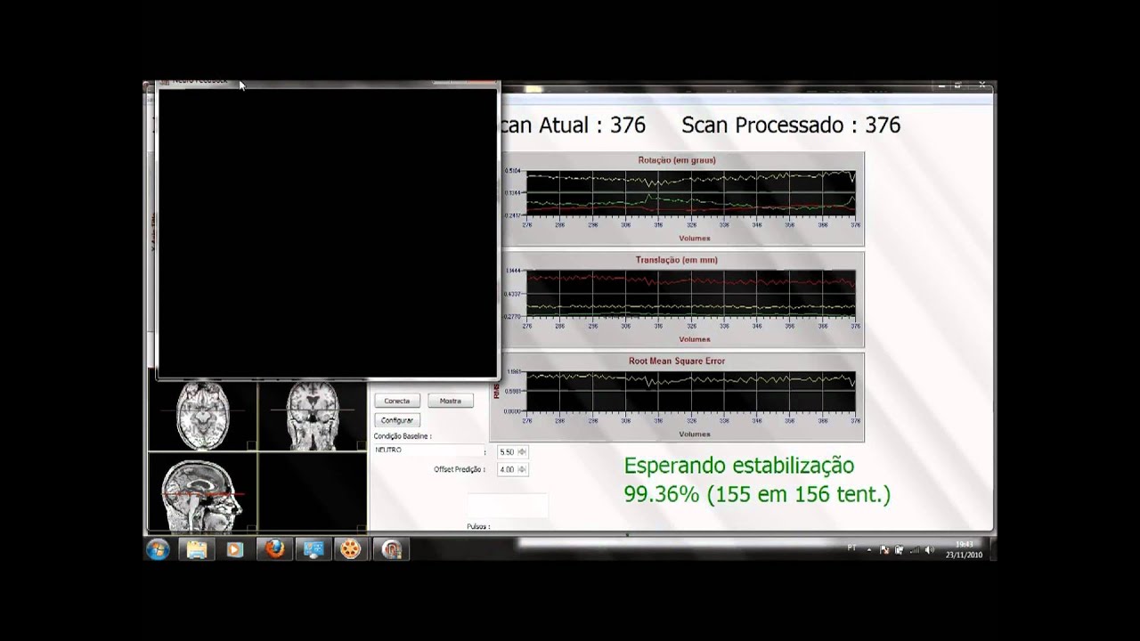 fMRI Neurofeedback IDOR final.wmv