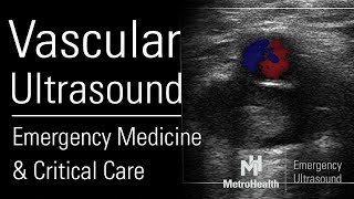 Vascular Ultrasound in Emergency Medicine & Critical Care screenshot 5