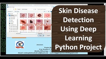 Skin Disease Detection Using Deep Learning | Skin Disease Detection Using Python Opencv Code