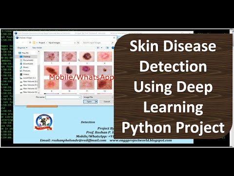Skin Disease Detection Using Deep Learning | Skin Disease Detection Using Python Opencv Code