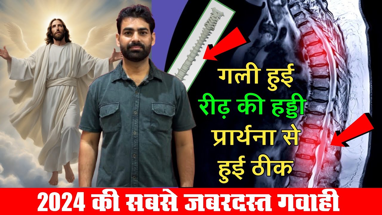 Hindu Man Sees Medical Miracle Through Jesus || हमने तो बिल्कुल आश छोड़ दी थी ||