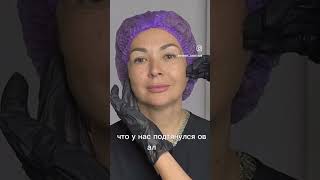 Отзыв от врача-косметолога о биоревитализантах VALODERM. Компания Оригомед #shorts #short