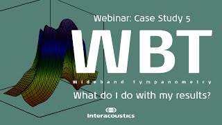 Wideband Tympanometry: Bilateral SSCD (5/6)